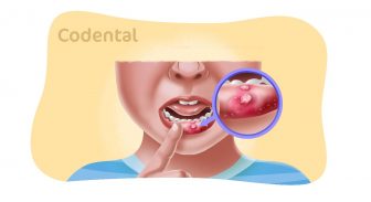 Estomatite Infantil: entenda a doença e o papel do dentista no controle