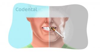 Cigarro e Saúde Bucal: como orientar seus pacientes no consultório