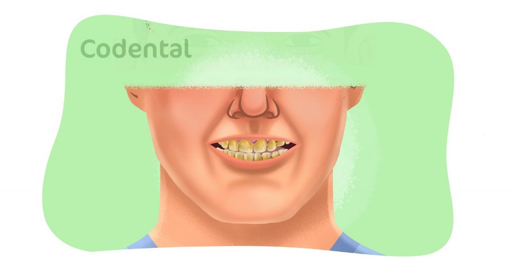 dentes amarelados