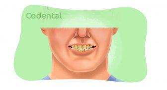 Dentes amarelados: um guia completo!