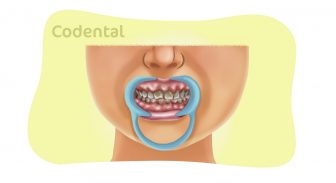 Dentinogênese Imperfeita: um guia completo para dentistas