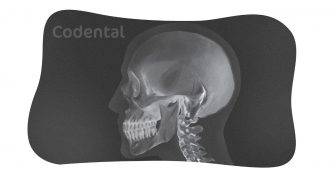 Radiografia cefalométrica: um guia completo sobre!