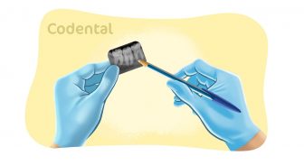 Compreensão de radiografias odontológicas: aprenda tudo sobre!