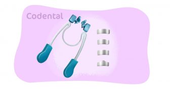 Ultramatrix na odontologia: guia completo para dentistas