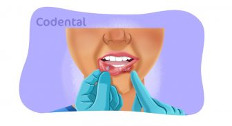Lesões fundamentais na mucosa oral: o que todo dentista precisa saber