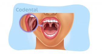Mucosa jugal: por que essa região merece mais atenção no consultório?