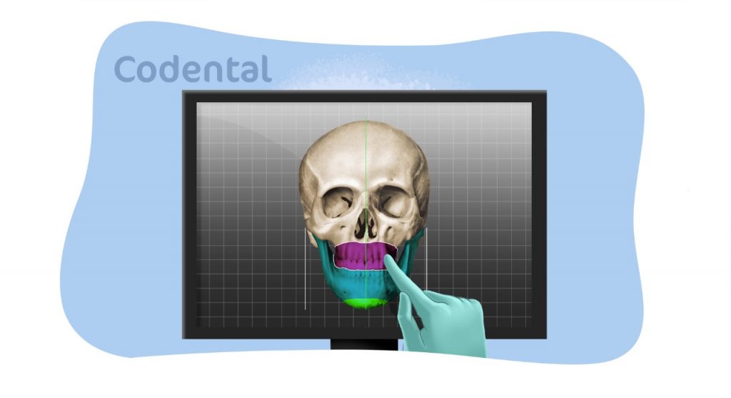 planejamento virtual de cirurgias odontológicas