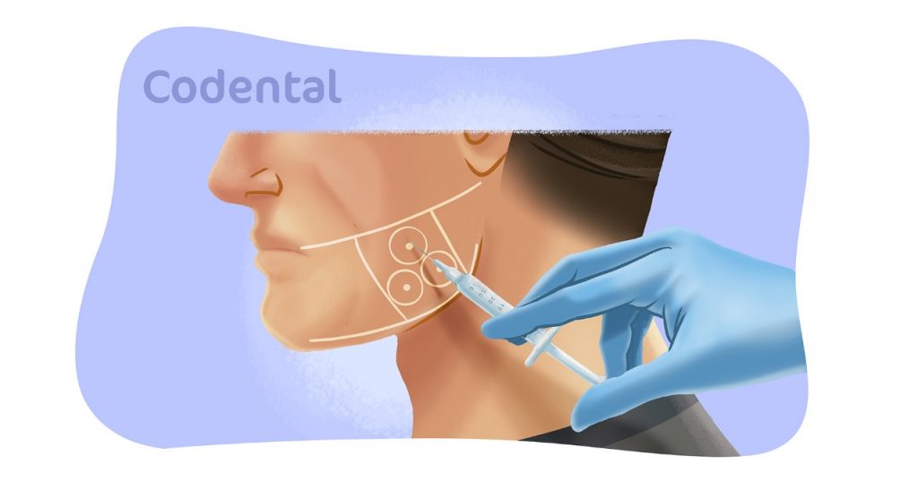 Botox no tratamento do bruxismo