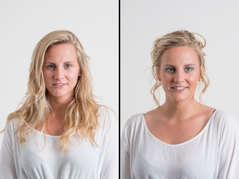 antes e depois da radiofrequência facial preparação