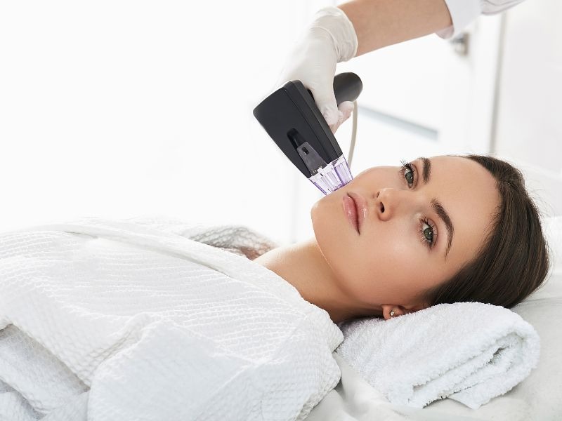 radiofrequência facial benefícios